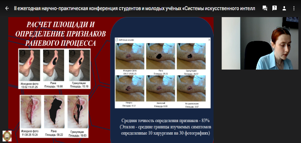 Итоги II ежегодной научно-практической конференции студентов и молодых учёных «Системы искусственного интеллекта в медицине и здравоохранении» Итоги II ежегодной научно-практической конференции студентов и молодых учёных «Системы искусственного интеллекта в медицине и здравоохранении»